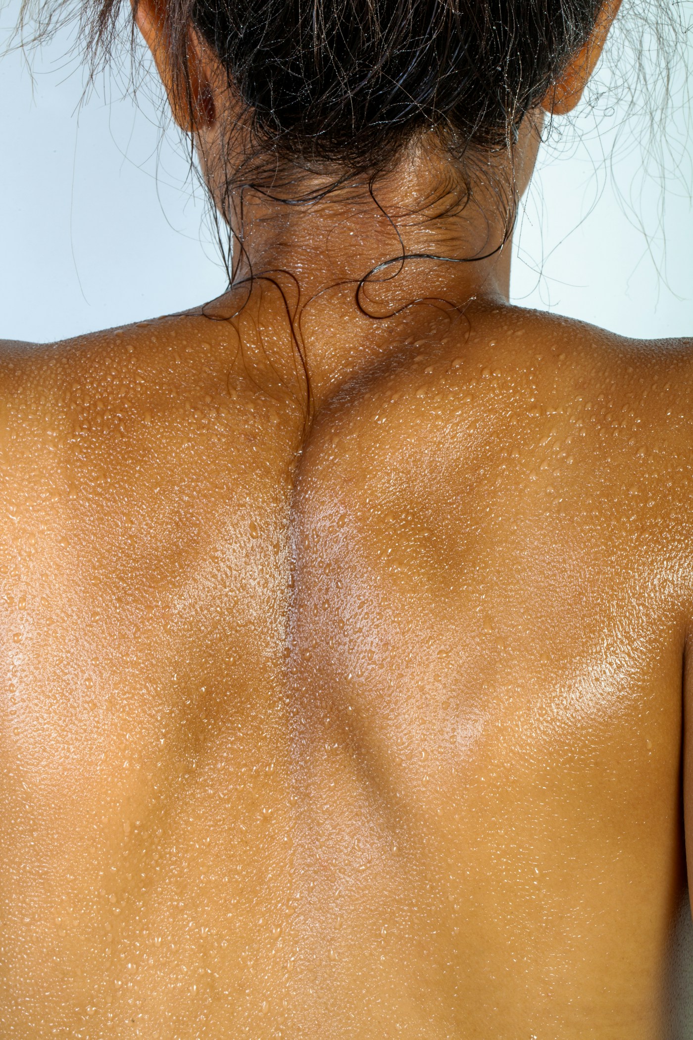 Vue rapprochée de la peau du dos et du cou. Photographie d’illustration, sans psoriasis ni lésion diagnostiquée.